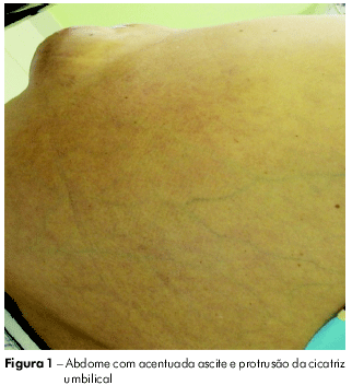 Quais são os Sintomas da Doença de Niemann-Pick? Neurocirurgião